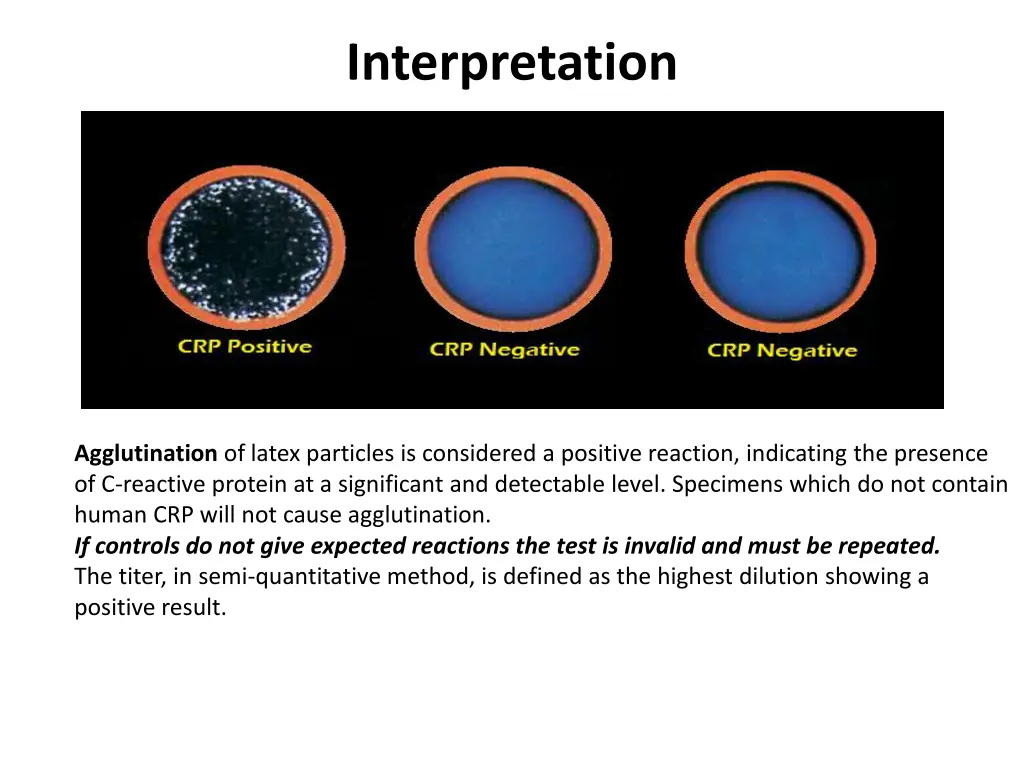 interpretation