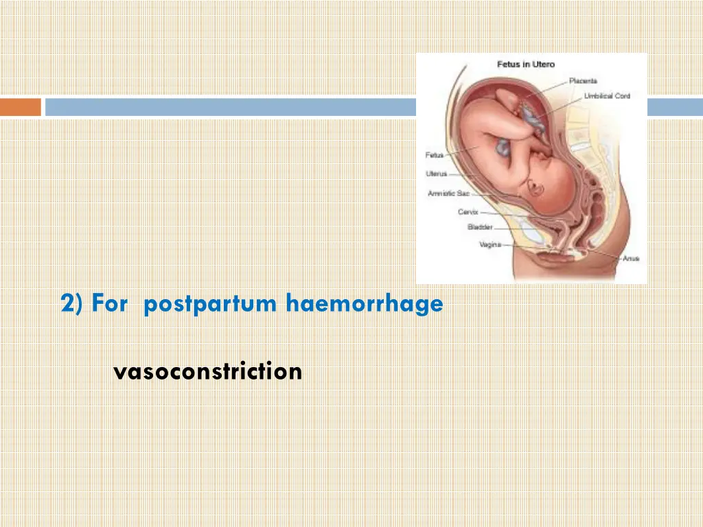 2 for postpartum haemorrhage