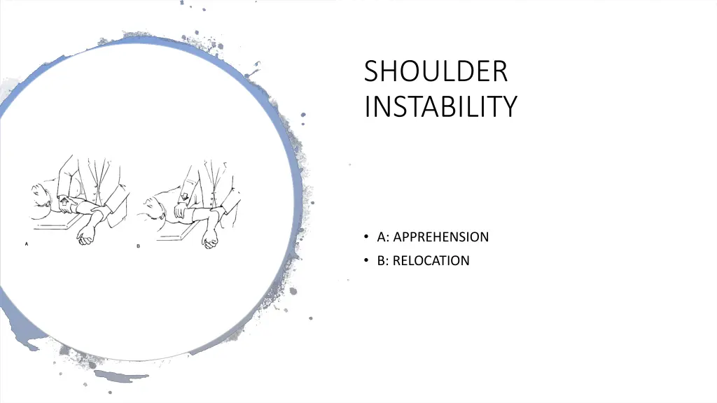 shoulder instability