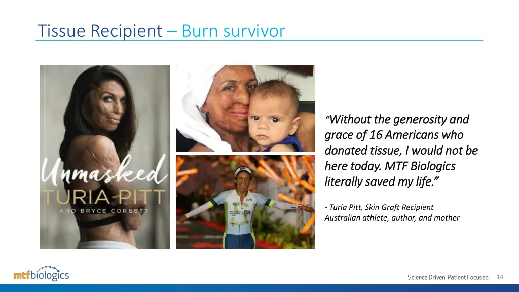 tissue recipient burn survivor