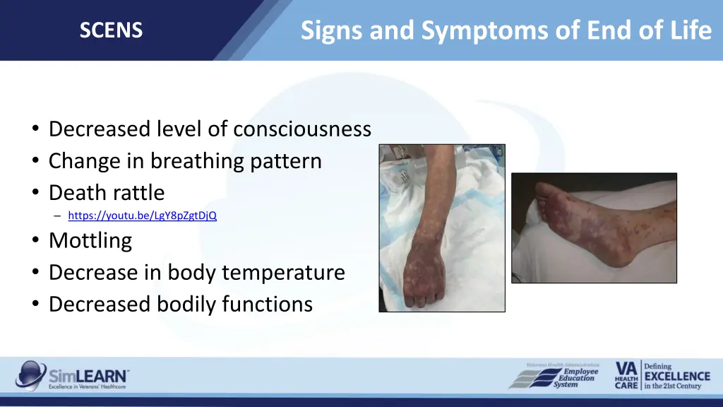 signs and symptoms of end of life