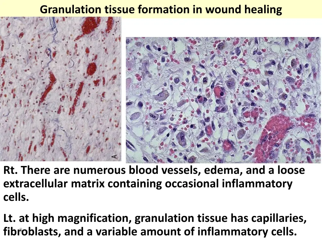 granulation tissue formation in wound healing