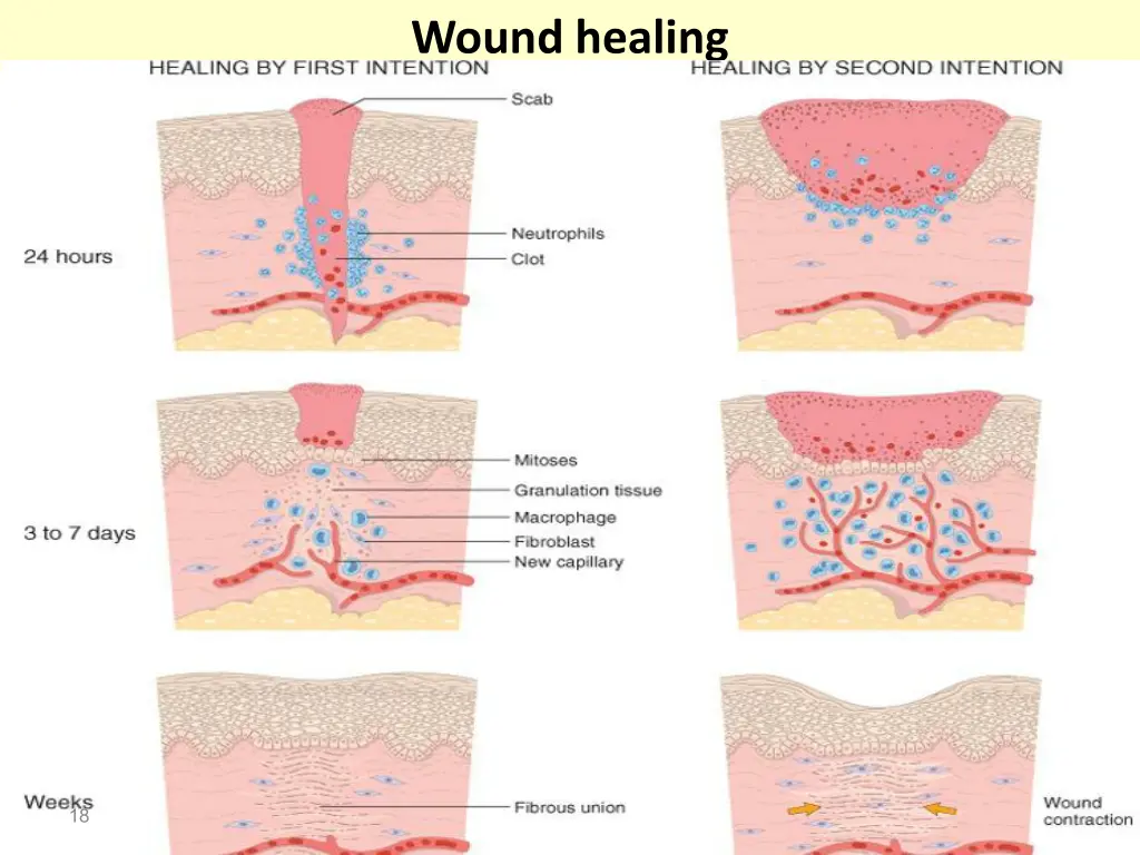 wound healing