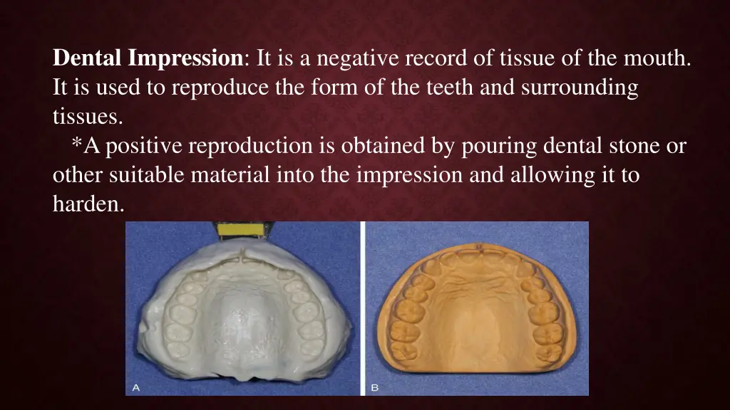 dental impression it is a negative record