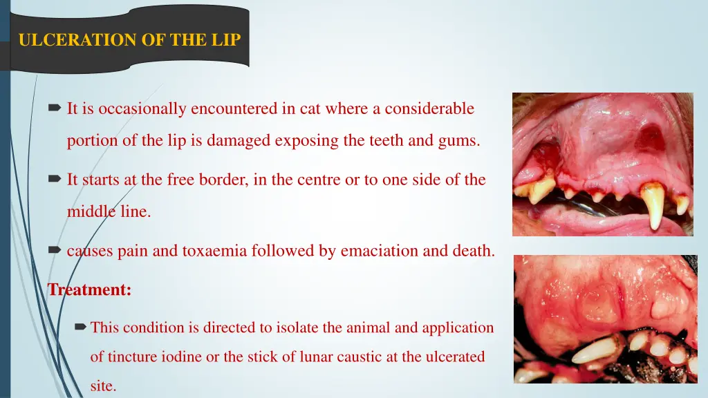 ulceration of the lip