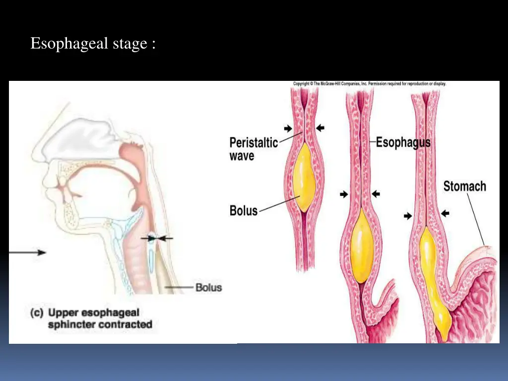 esophageal stage