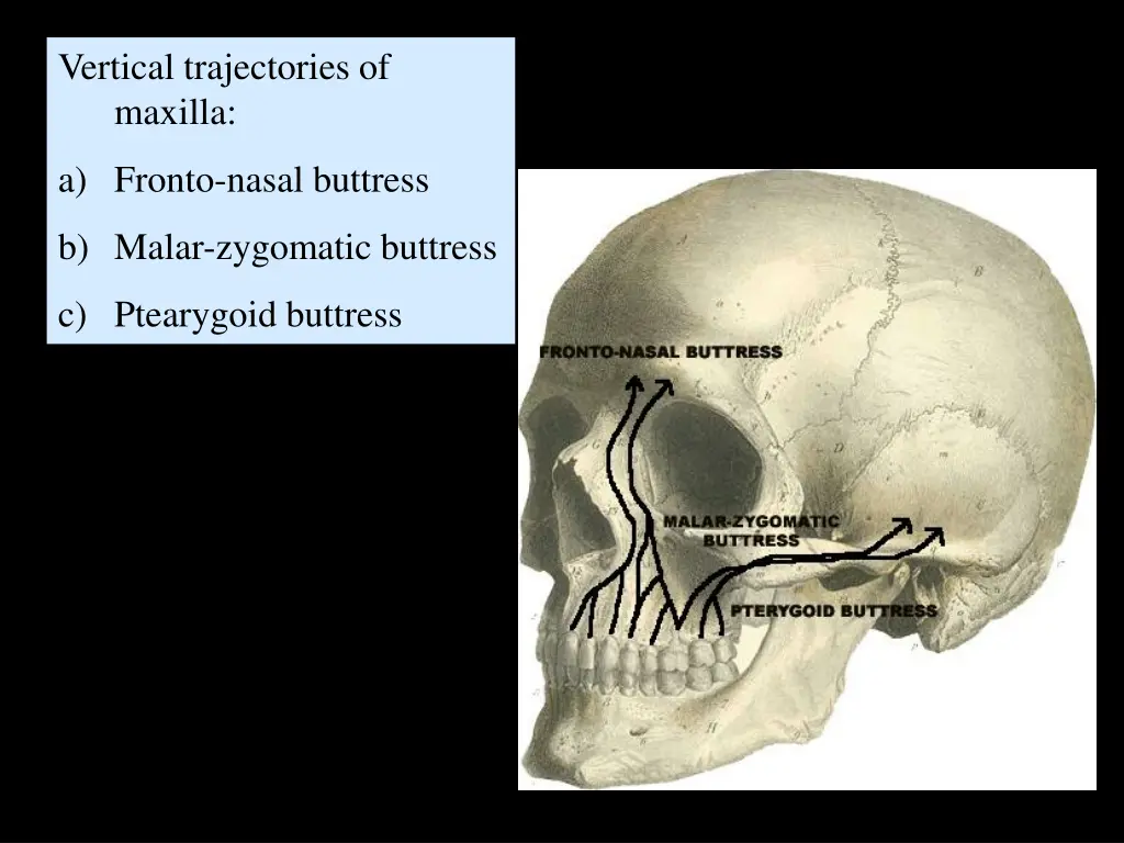 vertical trajectories of maxilla