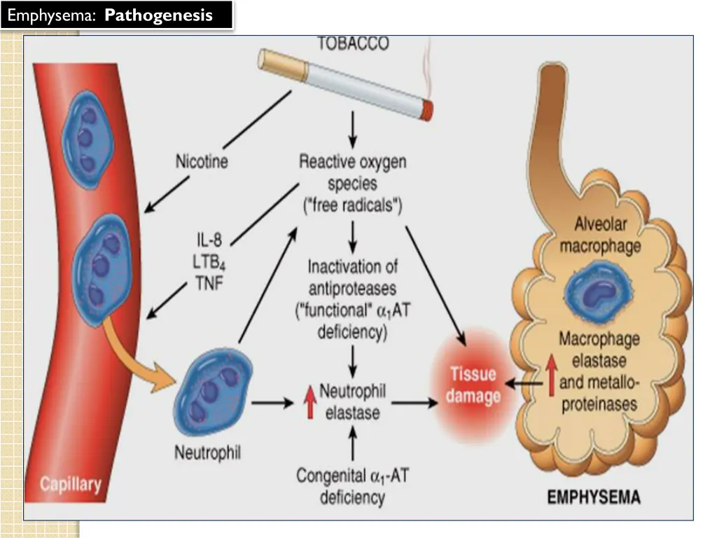 emphysema pathogenesis