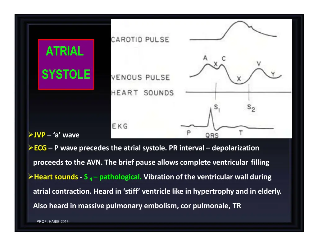 atrial