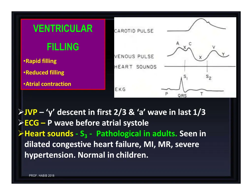 ventricular