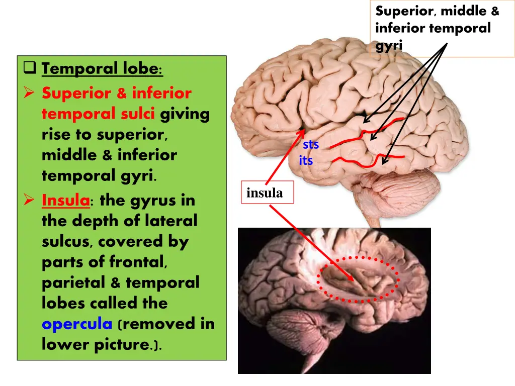 superior middle inferior temporal gyri