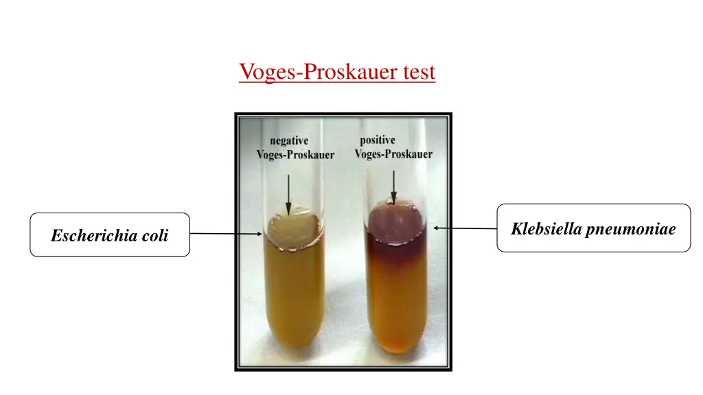 voges proskauer test 1