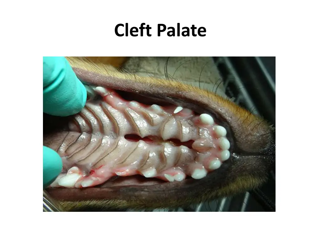 cleft palate