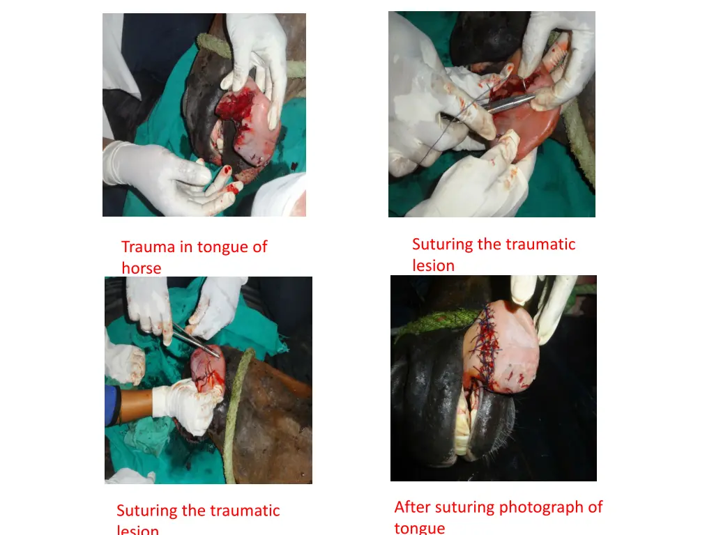 suturing the traumatic lesion