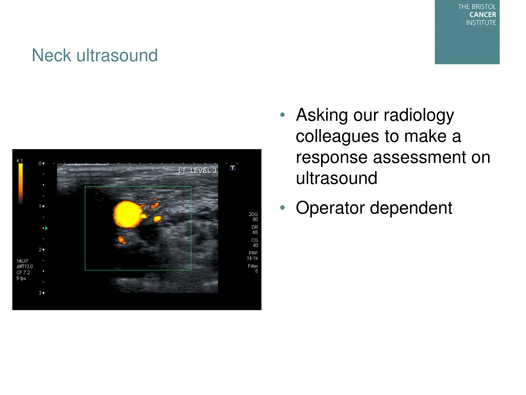 neck ultrasound