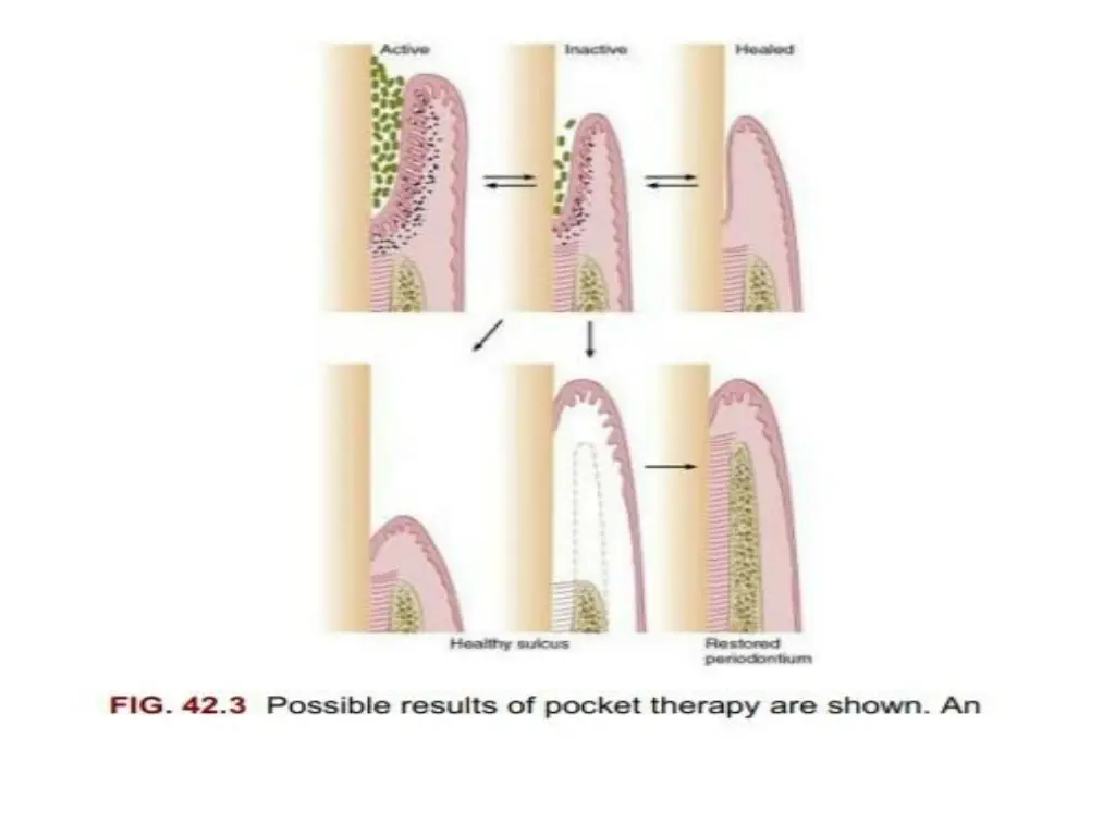 slide18