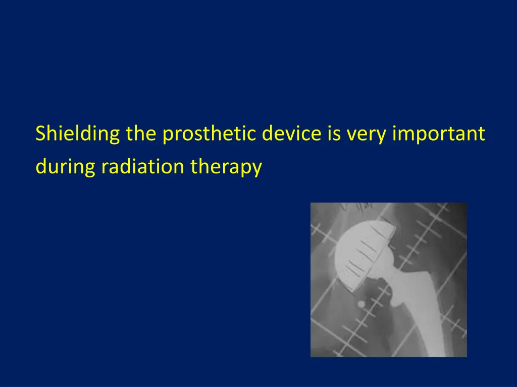 shielding the prosthetic device is very important