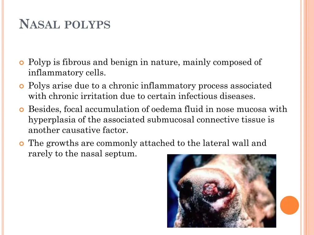 n asal polyps