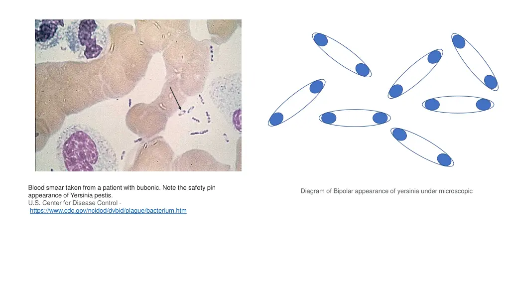 blood smear taken from a patient with bubonic