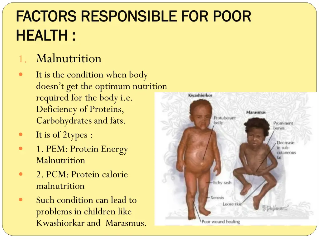 factors responsible for poor factors responsible