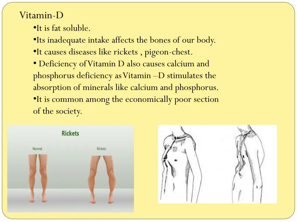 vitamin d it is fat soluble its inadequate intake