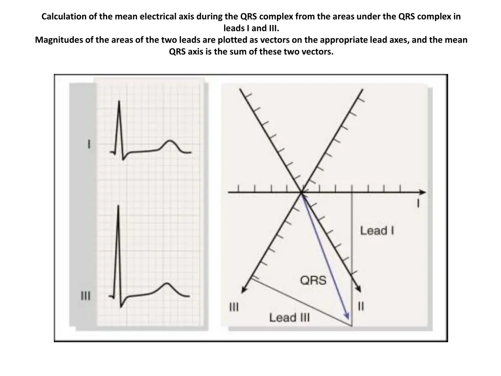 calculation of the mean electrical axis during