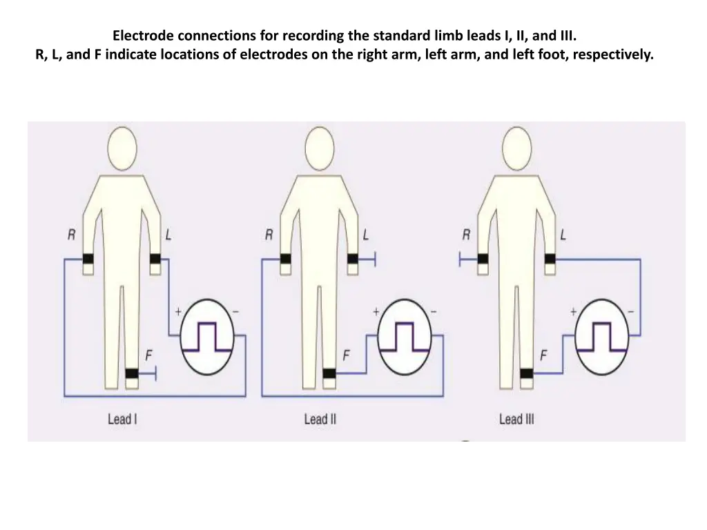 electrode connections for recording the standard