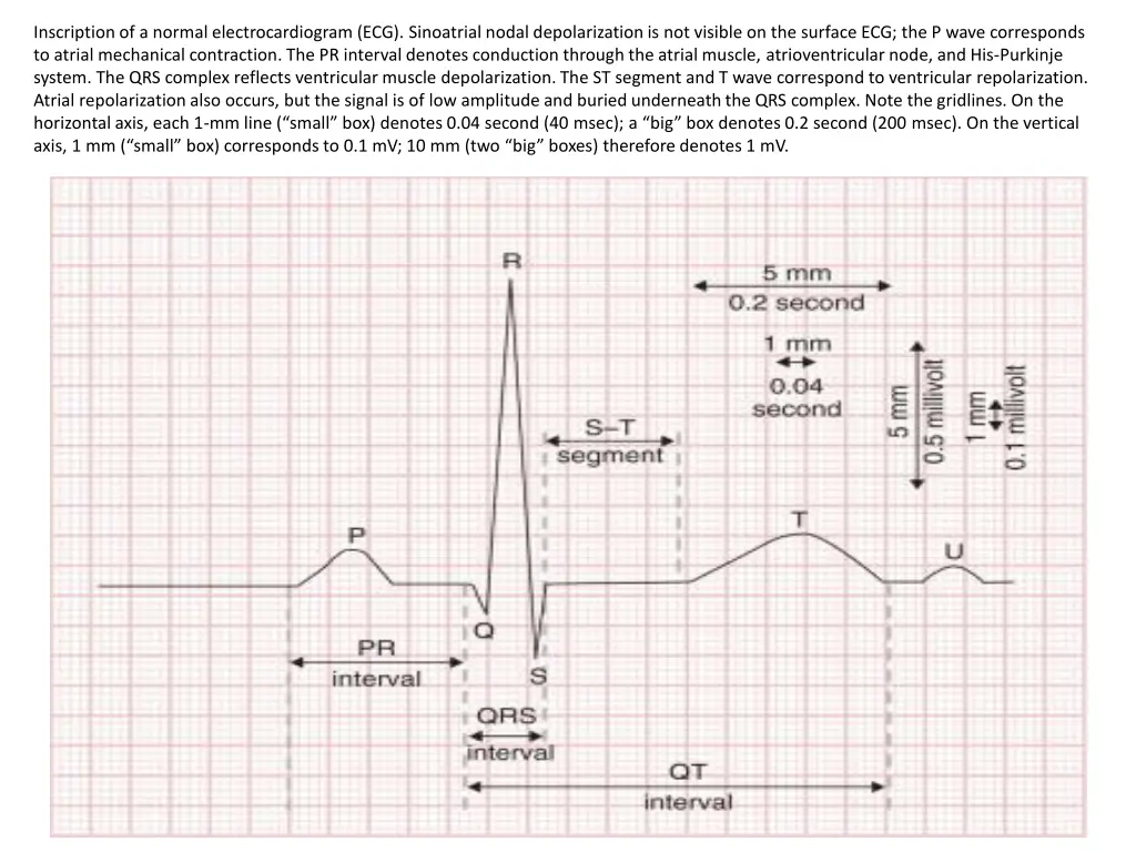 inscription of a normal electrocardiogram