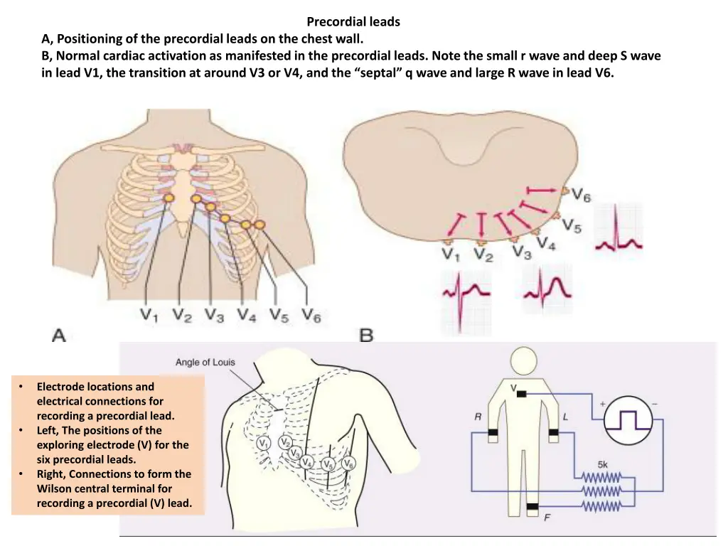 precordial leads