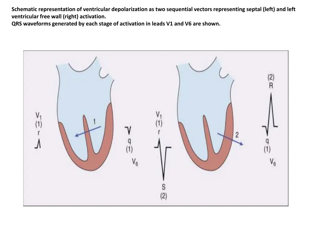 schematic representation of ventricular