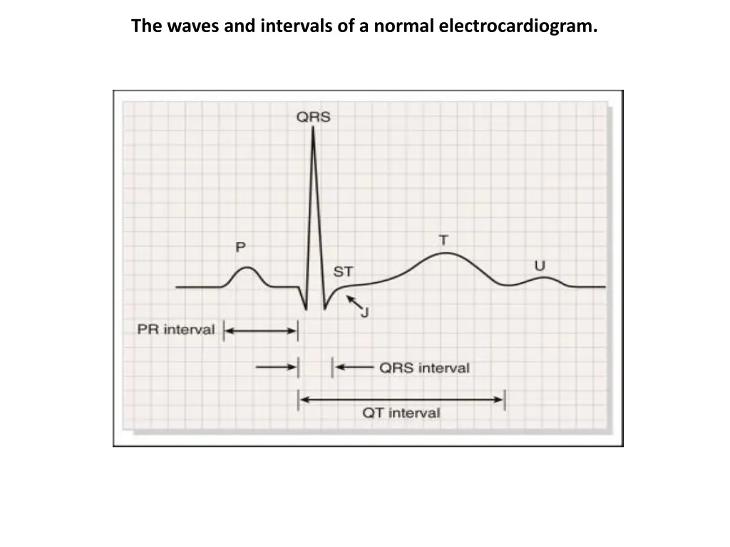 the waves and intervals of a normal