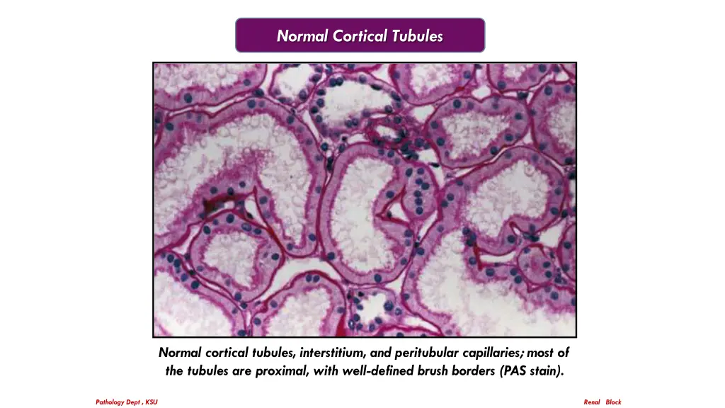 normal cortical tubules