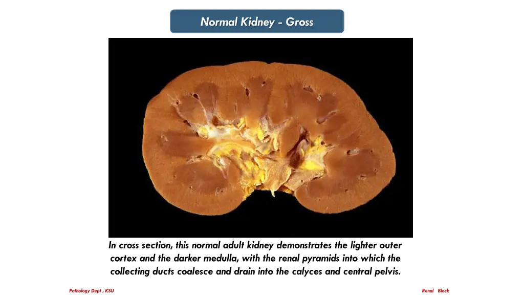 normal kidney gross