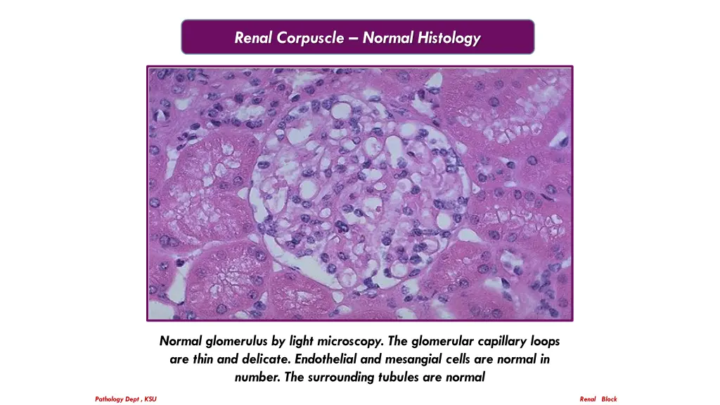 renal corpuscle normal histology 1