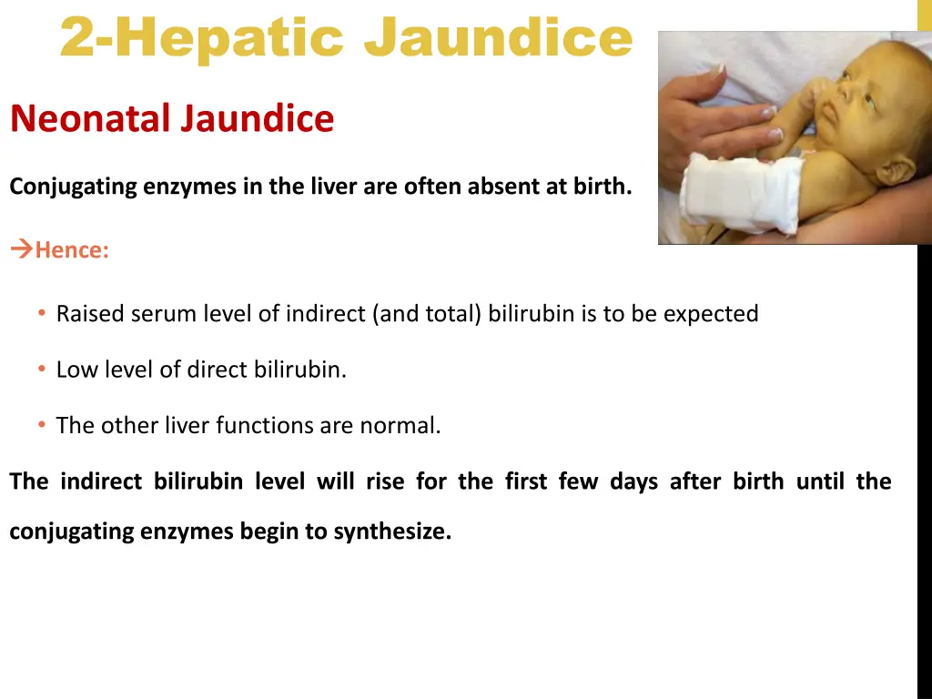 2 hepatic jaundice 1