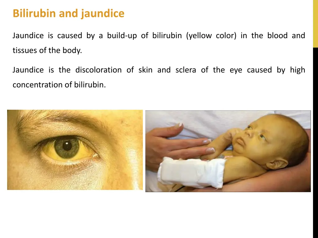 bilirubin and jaundice