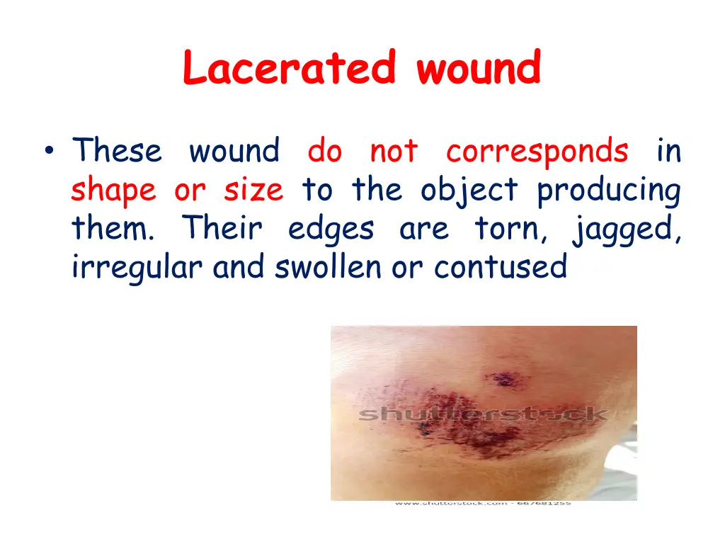 lacerated wound