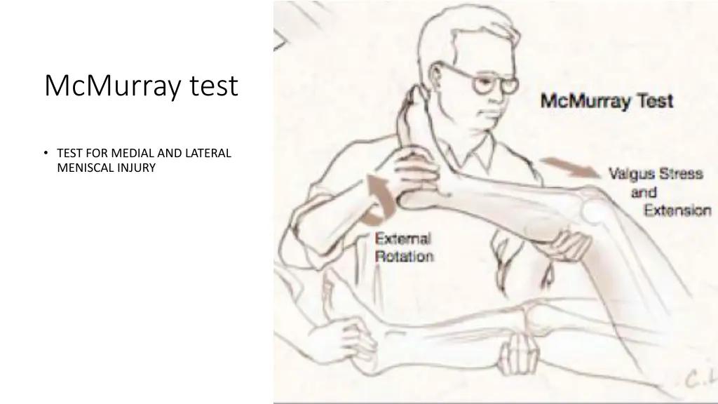 mcmurray test