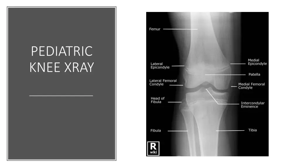 pediatric knee xray