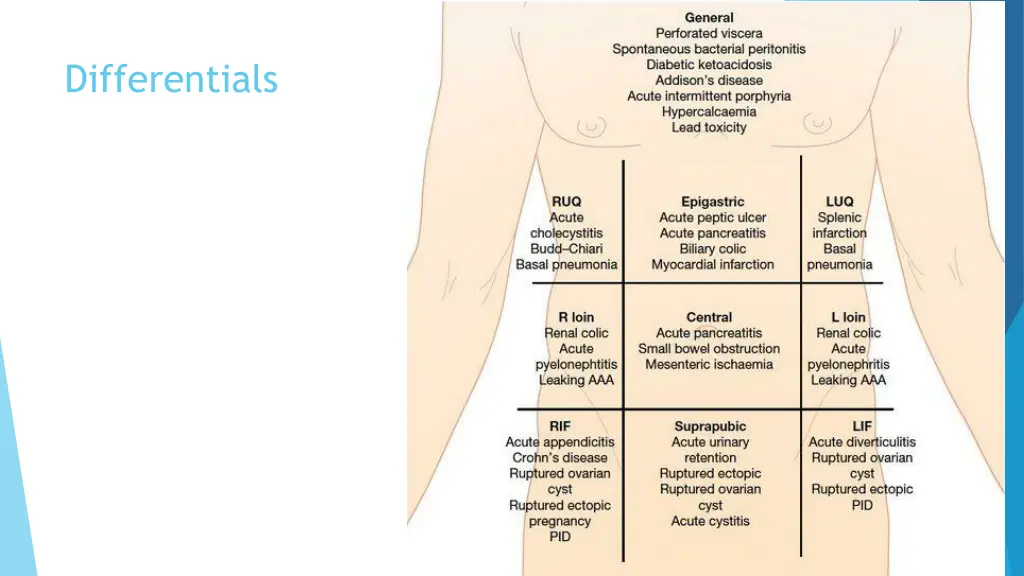 differentials 1