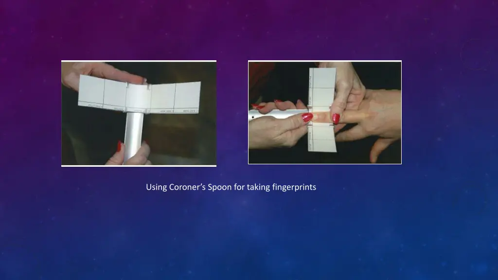 using coroner s spoon for taking fingerprints