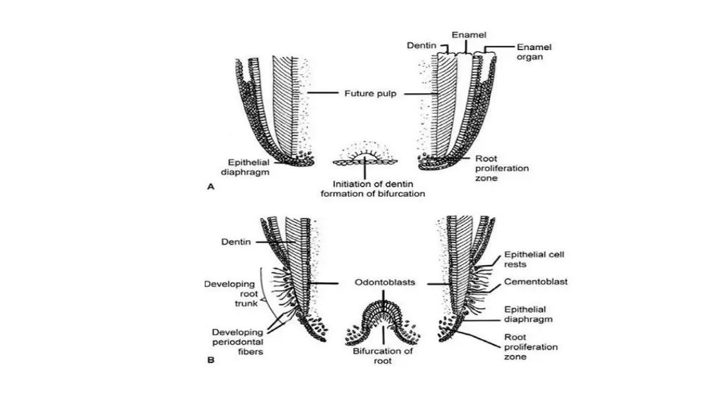 slide11