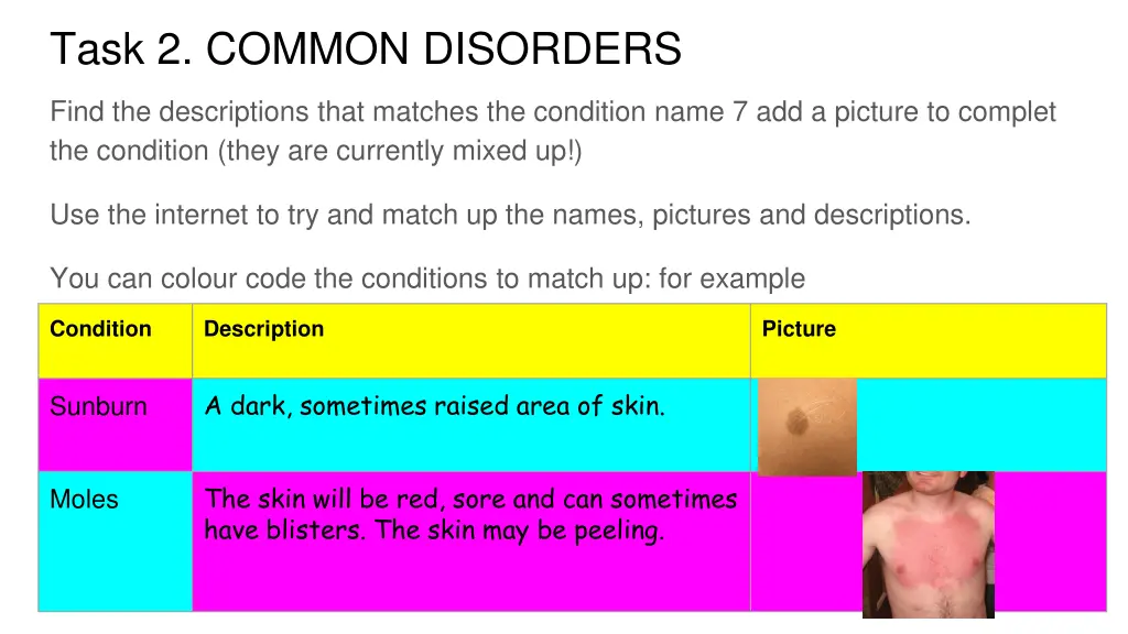 task 2 common disorders