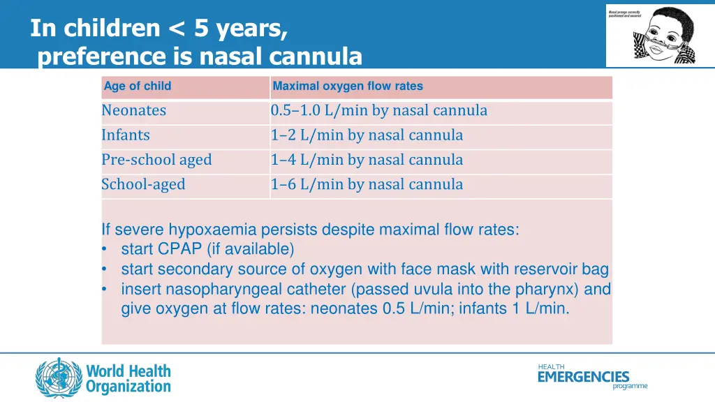 in children 5 years preference is nasal cannula