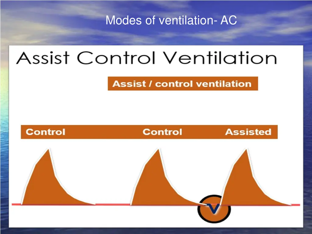 modes of ventilation ac