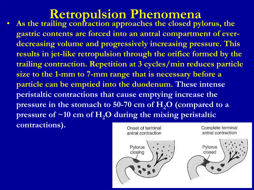 retropulsion phenomena as the trailing