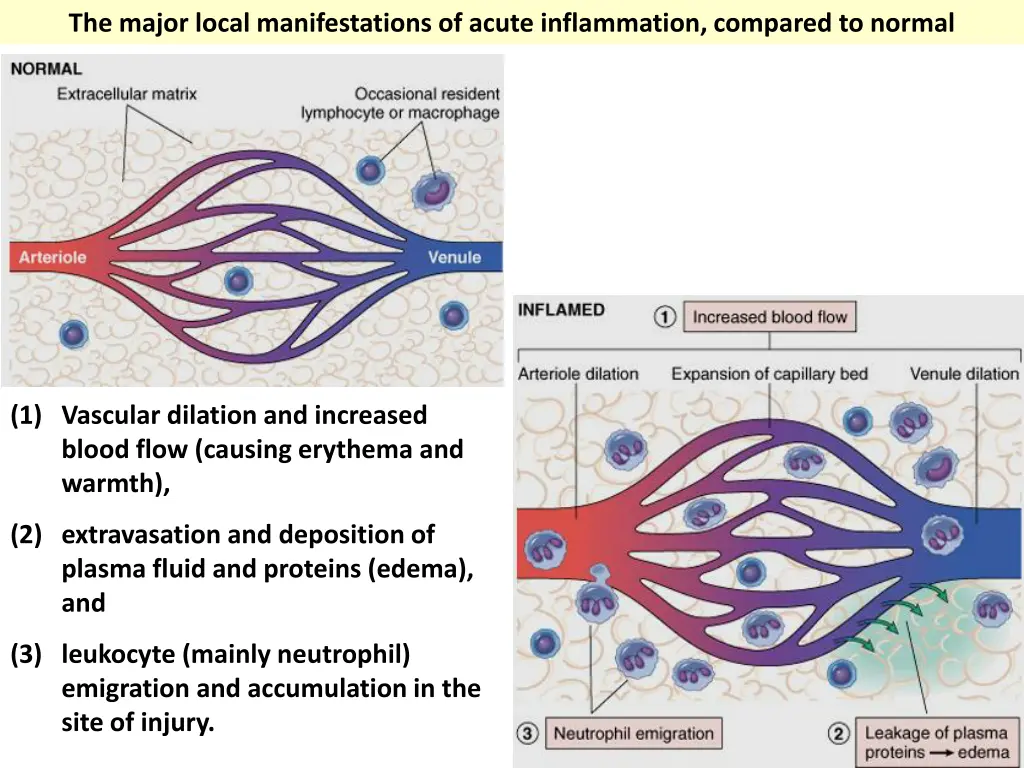 the major local manifestations of acute