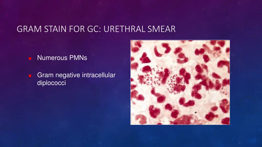 gram stain for gc urethral smear