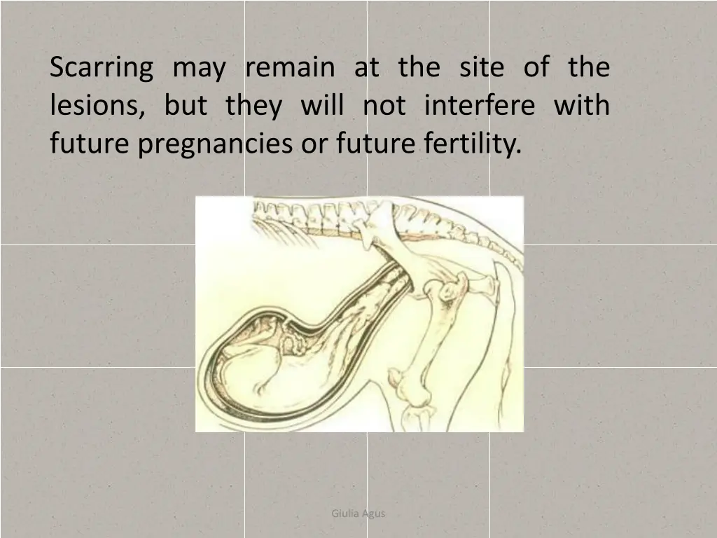 scarring may remain at the site of the lesions