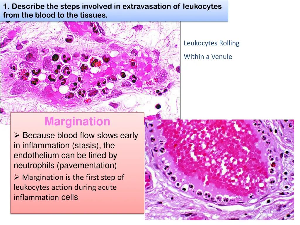 1 describe the steps involved in extravasation 3